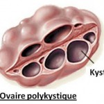 resveratrol ovaire polykystique